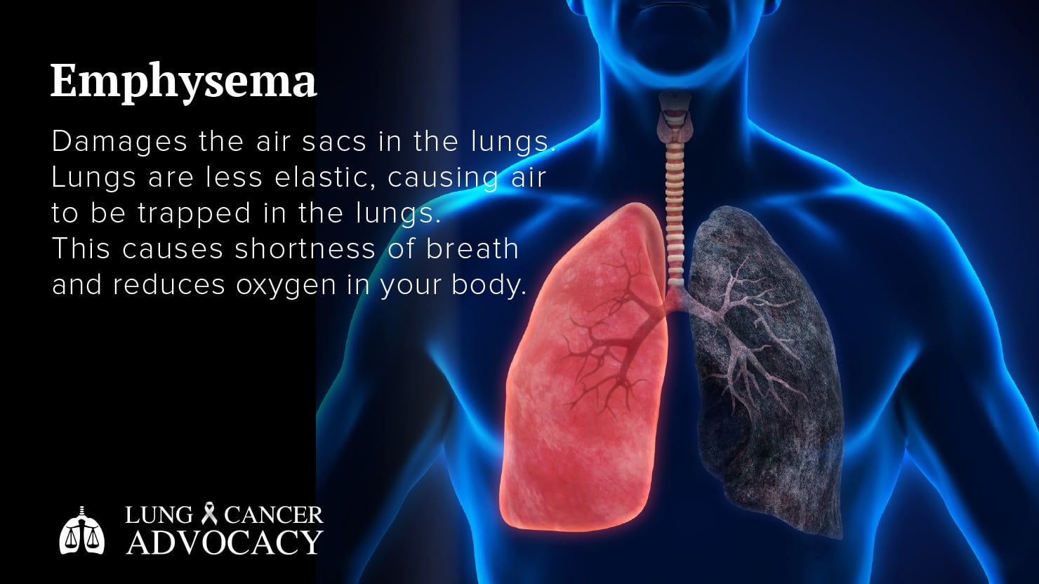 emphysema